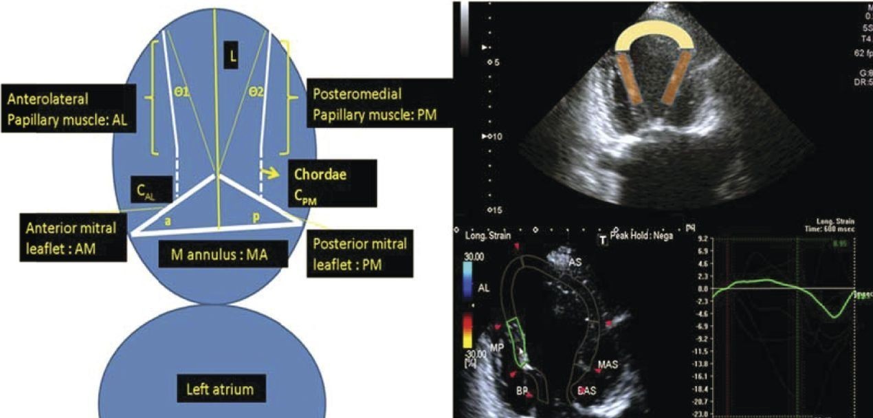 Strain balance of papillary muscles as a prerequisite for successful mitral valve repair in patients with mitral valve prolapse due to fibroelastic deficiency