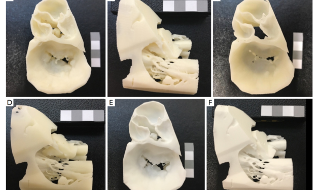 3D printing from cardiovascular CT: a practical guide and review