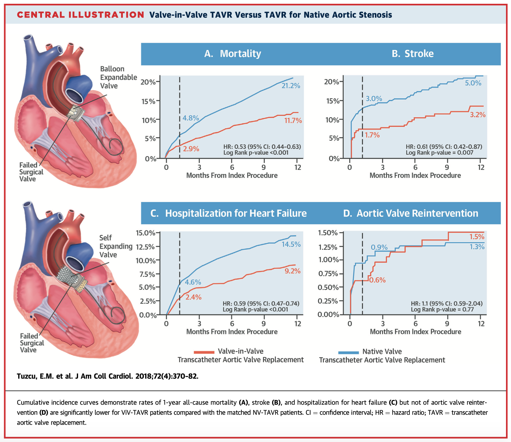 Aortic valve replacement long-term complications diabetes investing in etfs strategy definition